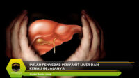 Penyebab Penyakit Liver