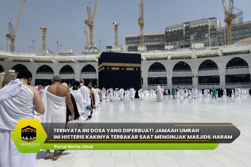 Jamaah Umrah Histeris Kakinya Terbakar