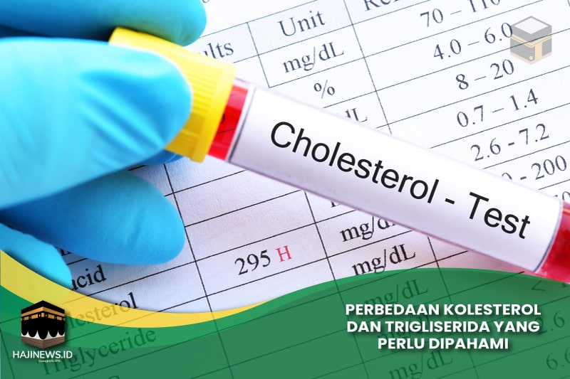 Perbedaan Kolesterol dan Trigliserida