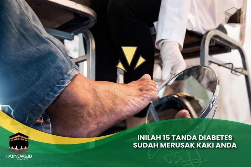 Tanda Diabetes Sudah Merusak Kaki