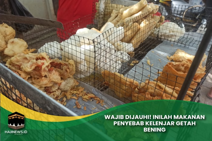 Makanan Penyebab Kelenjar Getah Bening