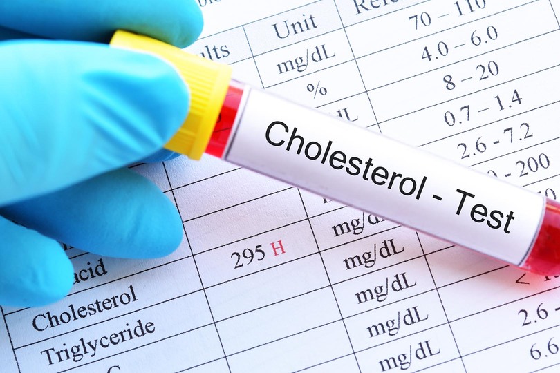 Cara Yang Dijamin Efektif Menurunkan Kolesterol